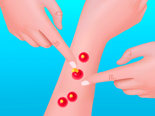Pimple Poper Rush game thumbnail